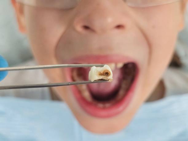 Best Emergency Dental Care for Trauma or Injury in Ridgetop, TN